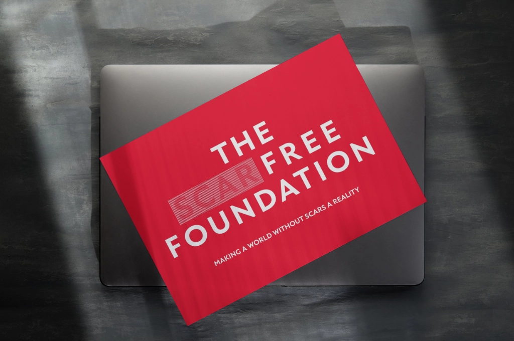 Red Scar Free Foundation branding material on laptop, tagline "Making a world without scars a reality
