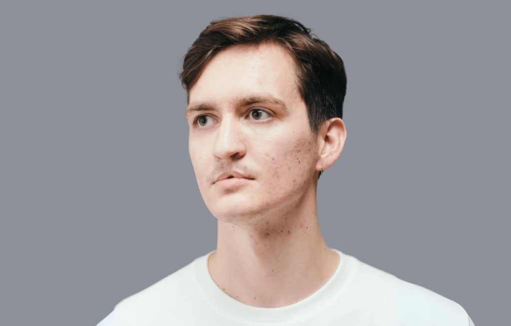 Man with cleft lip looking to the side against a gray background, wearing white t-shirt.