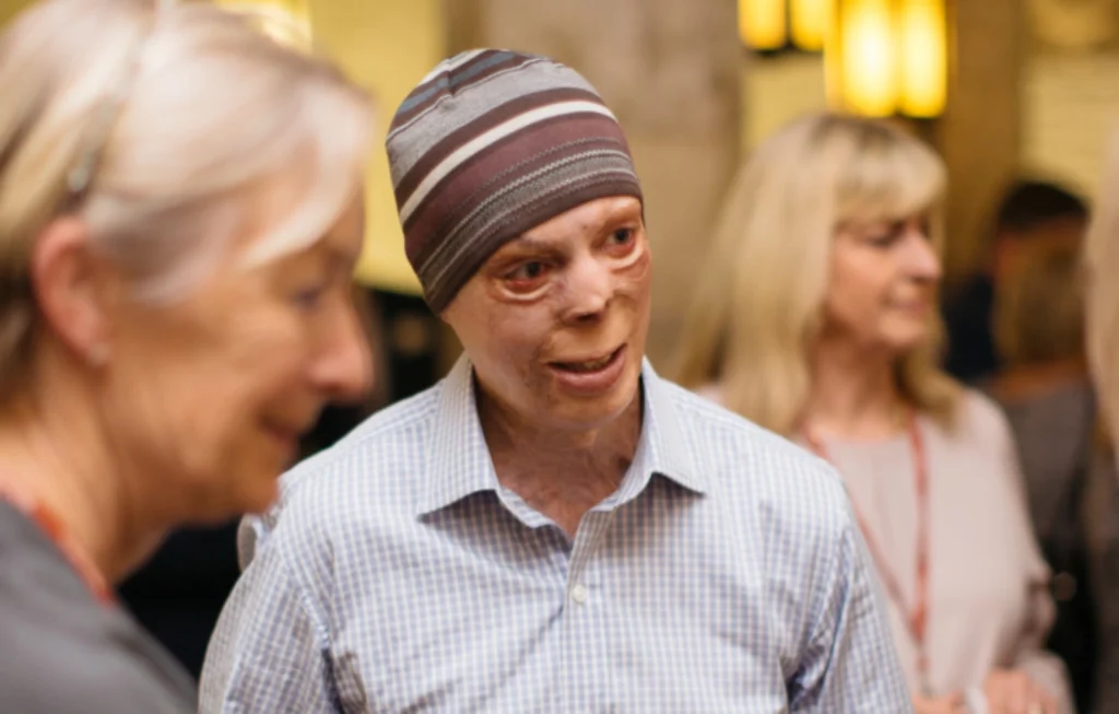 Man wearing striped beanie and light blue shirt smiling at social gathering with people in background.