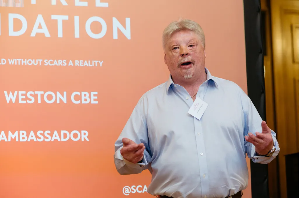 Simon Weston speaking at a Scar Free Foundation event, gesturing expressively during presentation.