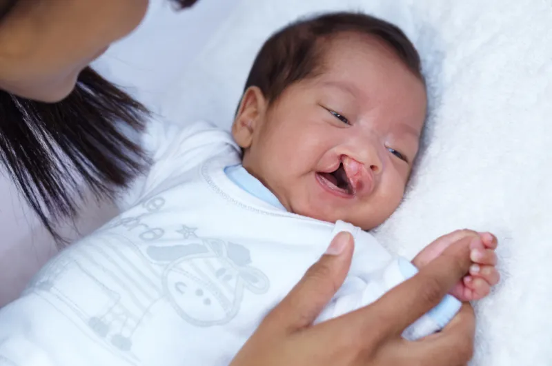 A newborn baby yawning while being held, wearing a white swaddle blanket with blue patterns.