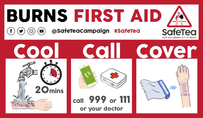 Burns first aid infographic showing cool water treatment for 20 minutes, calling emergency services, and covering with sterile dressing.