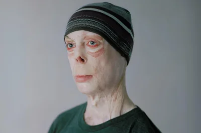 Martyn Compton in striped wooly hat.